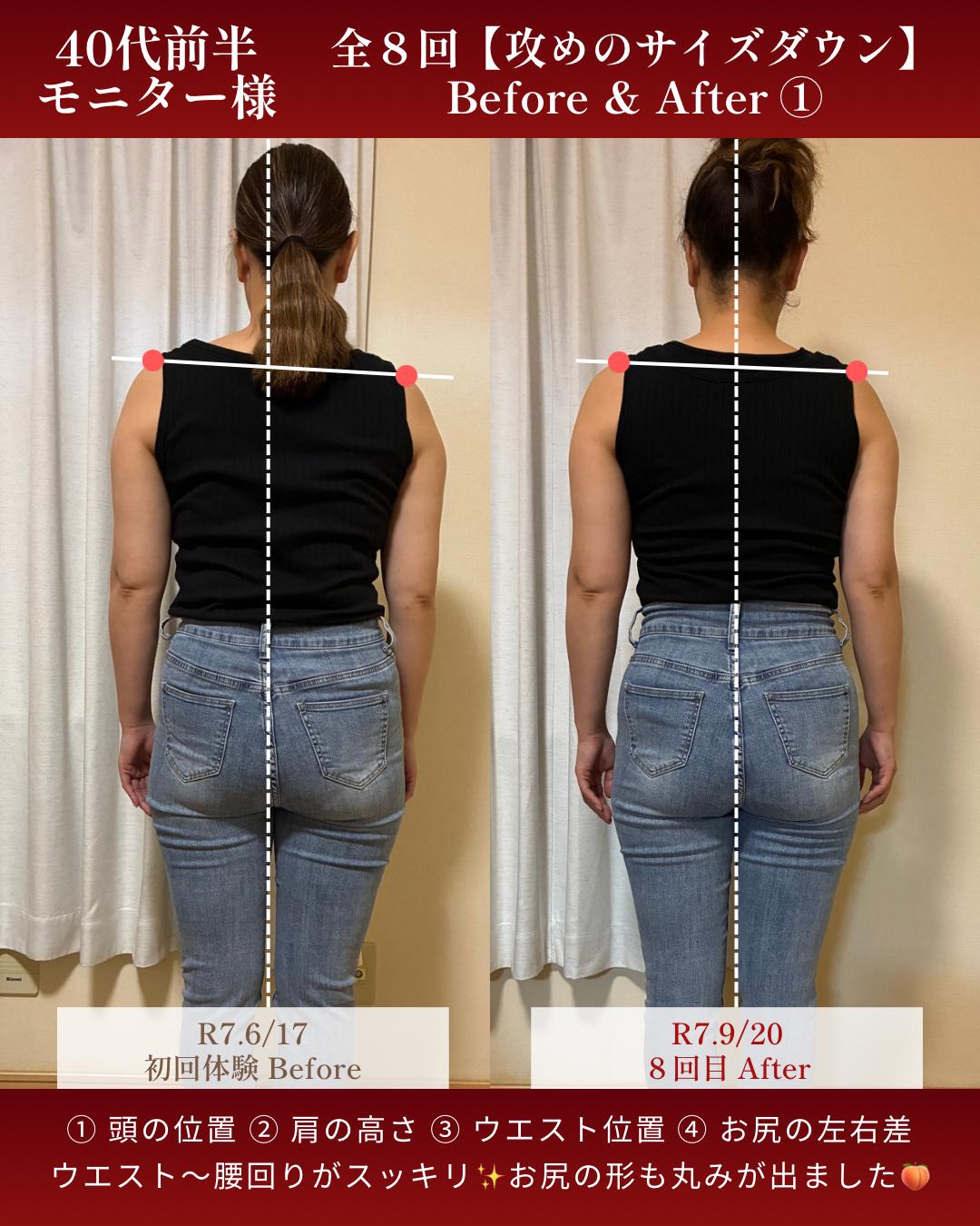 旭川市コアヒート専門温活エステサロンyunariの結果写真